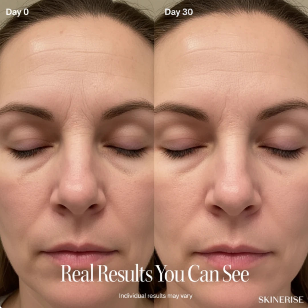 SkinErise™️ Complete Lift Kit – Lift, Brighten & De-Puff in 3 Minutes a Day