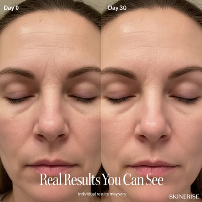 SkinErise™️ Complete Lift Kit – Lift, Brighten & De-Puff in 3 Minutes a Day